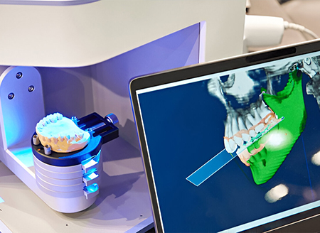 Tecnologie odontoiatriche avanzate per chirurgia guidata a Caltagirone