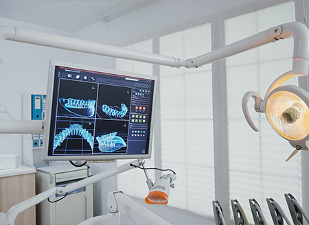 Implantologia dentale a Caltagirone – sorriso sano e duraturo