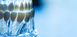 Tecnologie odontoiatriche avanzate per chirurgia guidata